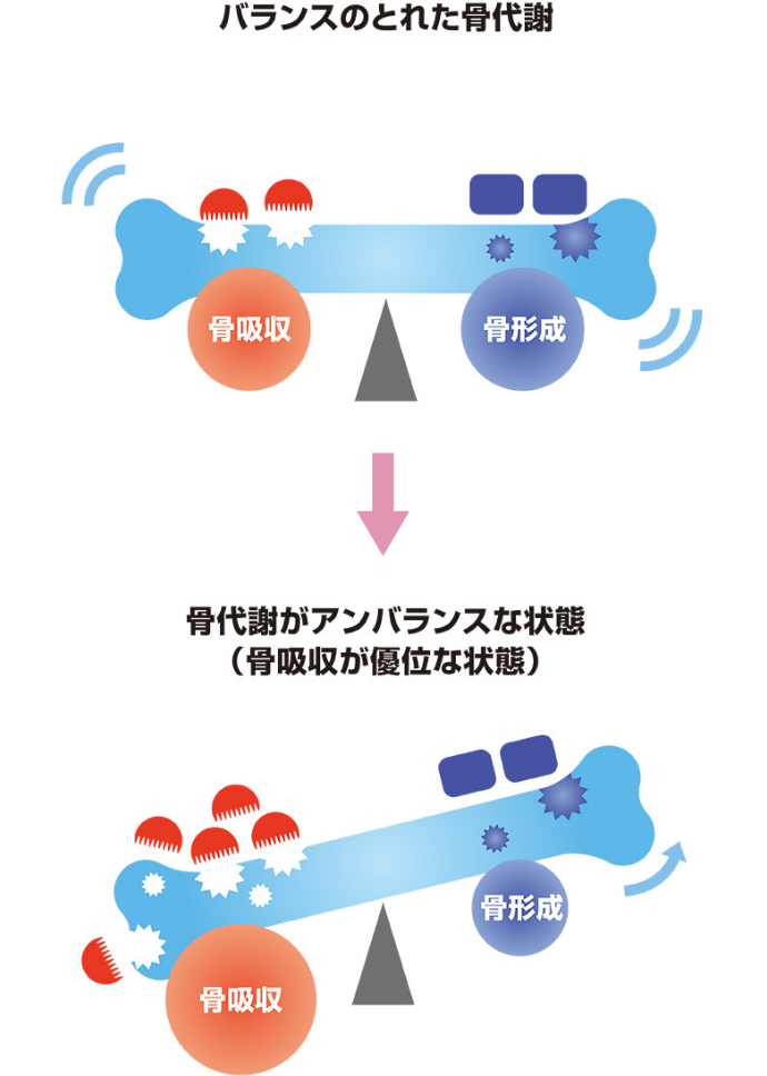 骨代謝のバランスイメージ